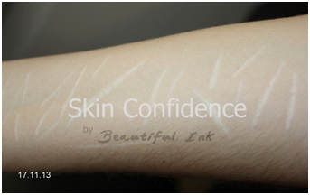 Self harm scarring after dry tattooing